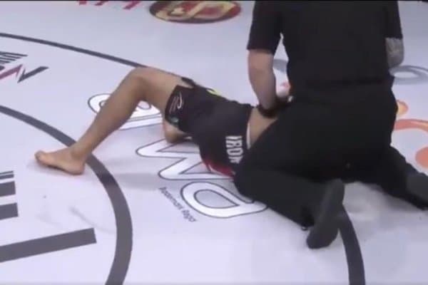 ММА жангчиси даҳшатли жароҳат олди