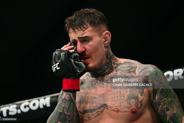 Том Аспиналлнинг кўзи жиддий жароҳат олганми?