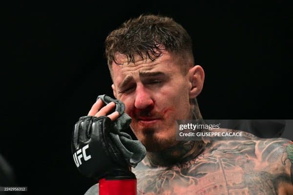 Кўзидан жароҳат олган Том Аспиналлнинг ММАдаги келажаги ҳамон мавҳумлигича қолмоқда