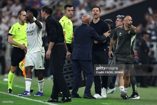 Хаби Алонсо Симеоненинг хатти-ҳаракатларини танқид қилди