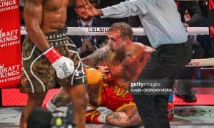 Жейк Пол Энтони Жошуа билан жангдан кейин яна бир бор жағини операция қилдирди