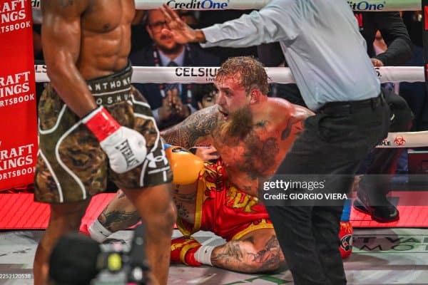 Жейк Пол Энтони Жошуа билан жангдан кейин яна бир бор жағини операция қилдирди