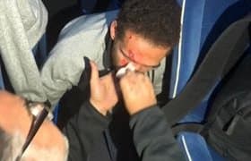 Тунислик мухлислар "Ал-Ахли" клуби автобусига ҳужум қилишди