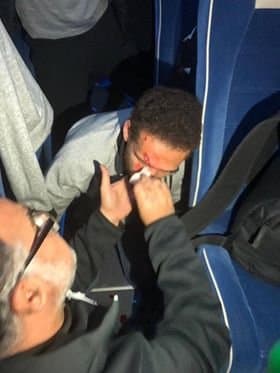 Тунислик мухлислар "Ал-Ахли" клуби автобусига ҳужум қилишди