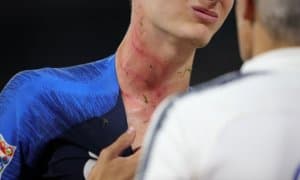 Рюдигер кечаги баҳсда Паварга жиддий жароҳат етказишига сал қолди (видео)