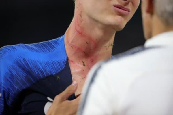 Рюдигер кечаги баҳсда Паварга жиддий жароҳат етказишига сал қолди (видео)